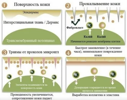 Мезотерапія для схуднення відгуки, протипоказання, результати (відгуки) Мезотерапія для схуднення відгуки, протипоказання, результати