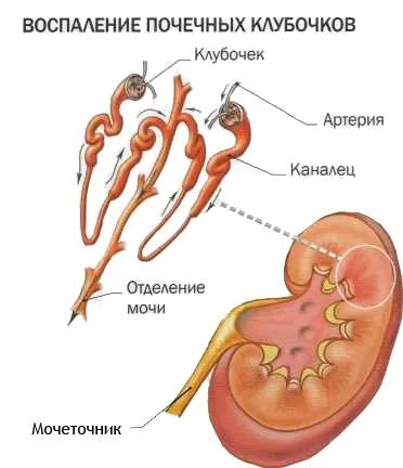 Сеча з кров'ю у чоловіків причини (сеча) Сеча з кров'ю у чоловіків причини