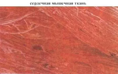 М'язи і їхня функція (швидше за розвивається стомлення) М'язи і їхня функція