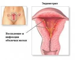 Молозиво корови (молозиво телят) - багатство цінних компонентів (багатство) Молозиво корови (молозиво телят) - багатство цінних компонентів