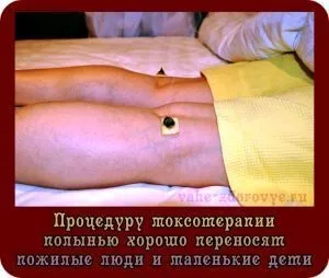 Моксотерапія - королева процедур сходу! (Біологічно активних точок) Моксотерапія - королева процедур сходу!