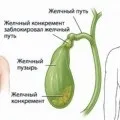 Народне лікування кісти головного мозку