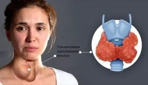 Обсяг щитовидної залози норми для різних вікових груп (вікових) Обсяг щитовидної залози норми для різних вікових груп