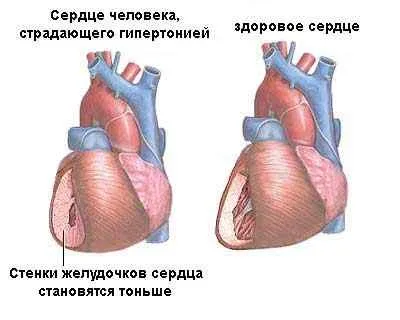 Normalife де купити ціна в аптеці і відгуки лікарів (купити) Normalife де купити ціна в аптеці і відгуки лікарів
