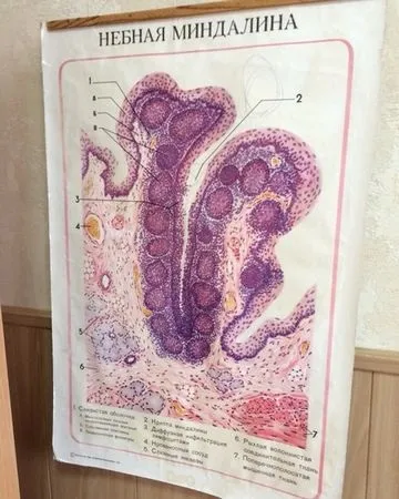 Піднебінних мигдалин гістологія