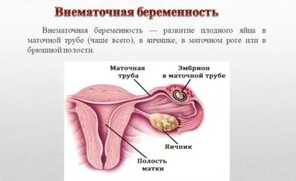 Негормональні протизаплідні таблетки нового покоління (покоління) Негормональні протизаплідні таблетки нового покоління