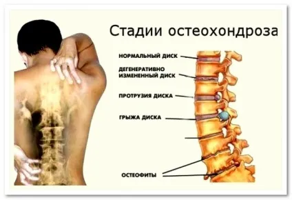 Німіє щелепу причини оніміння