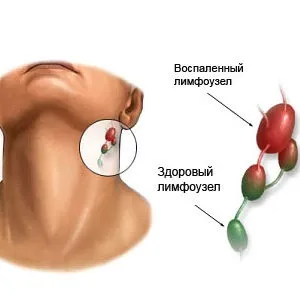 Неприємний запах за вухами у дорослих причини і чим лікувати