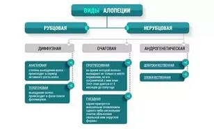 Обласна і випадання волосся причини лікування профілактика - програми - андрогенетичного облисіння