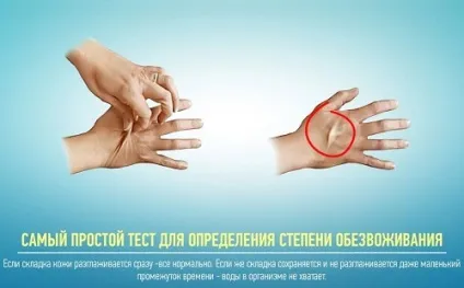 Зневоднення організму як проявляється і наслідки (зневоднення) Зневоднення організму як проявляється і наслідки