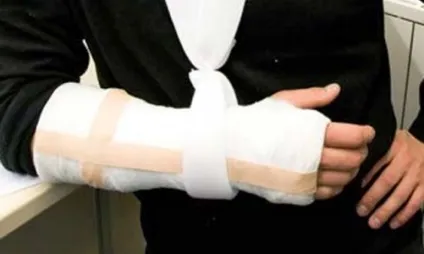 Про що потрібно пам'ятати, накладаючи гіпсову пов'язку на руку (потрібно) Про що потрібно пам'ятати, накладаючи гіпсову пов'язку на руку
