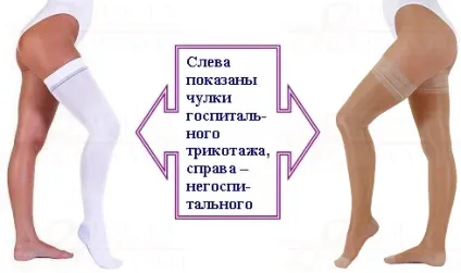 Про госпітальному або антіемболіческом трикотажі як різновиду компресійного (компресійного) Про госпітальному або антіемболіческом трикотажі як різновиду компресійного