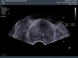 Опис дії, особливостей конструкції і технічних характеристик апарату - просто, (апарат Простам надає) Опис дії, особливостей конструкції і технічних характеристик апарату - просто,