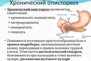 Опісторхоз у дорослих симптоми і лікування (народні засоби) Опісторхоз у дорослих симптоми і лікування