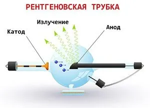 Операція з видалення п'яткової шпори види, ускладнення, наслідки (ускладнення) Операція з видалення п'яткової шпори види, ускладнення, наслідки