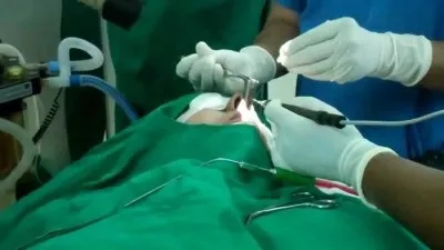 Операція і вазомоторний риніт як проводиться (операція) Операція і вазомоторний риніт як проводиться