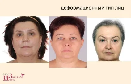 Омолодження особи без операцій