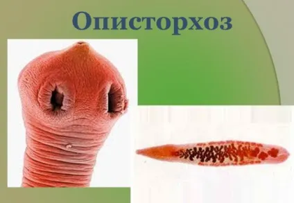 Опісторхоз у дорослих симптоми і лікування (лікування) Опісторхоз у дорослих симптоми і лікування