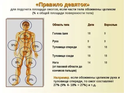 Визначення площі опіку (правило дев'яток, долоні)