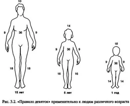 Визначення площі опіку