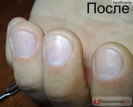 Обрізний манікюр (класичний) в салоні - «одкровення майстра манікюру класичний манікюр в (манікюр) Обрізний манікюр (класичний) в салоні - «одкровення майстра манікюру класичний манікюр в
