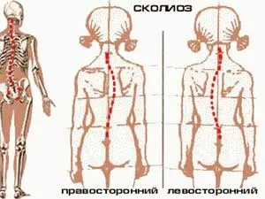 Основні ортопедичні проблеми, що виникають у дітей до 3 років, і їх лікування (популярне) Основні ортопедичні проблеми, що виникають у дітей до 3 років, і їх лікування