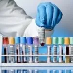 Від чого залежить рівень холестерину вік, раціон і регіон