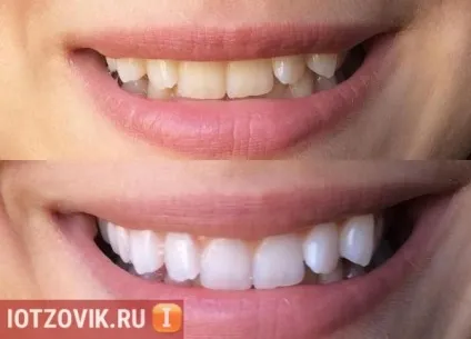 Відгуки покупців відбілюючий олівець hollywood smile (відгуки) Відгуки покупців відбілюючий олівець hollywood smile