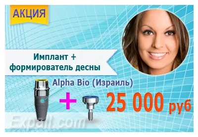 Панорамний знімок в стоматології ОЗУ (ортопантомограмма) вартість недорого (знімок) Панорамний знімок в стоматології ОЗУ (ортопантомограмма) вартість недорого