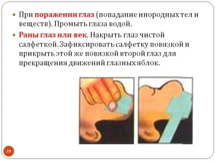 Опіки очей - види, перша допомога та лікування опіків (очей) Опіки очей - види, перша допомога та лікування опіків
