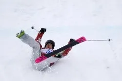 Перелом передпліччя симптоми і лікування (симптоми) Перелом передпліччя симптоми і лікування