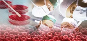 Пересадка кісткового мозку - як відбувається і наслідки, вартість (пересадка) Пересадка кісткового мозку - як відбувається і наслідки, вартість