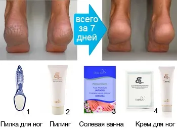 Пілінг зі шкіри та жиру змії tiande (відлущування) Пілінг зі шкіри та жиру змії tiande