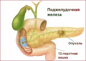 Чому болить живіт під ребрами найпоширеніші причини (живіт) Чому болить живіт під ребрами найпоширеніші причини