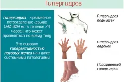 Чому ноги холодні і пітніють способи вирішення проблеми