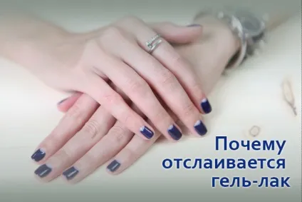 Чому не тримається гель-лак на нігтях причини відшарування (гель-лак) Чому не тримається гель-лак на нігтях причини відшарування