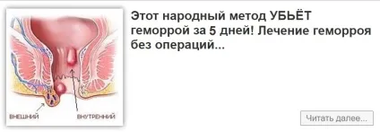 Поліп антрального відділу шлунка, лікування і симптоми (антрального) Поліп антрального відділу шлунка, лікування і симптоми
