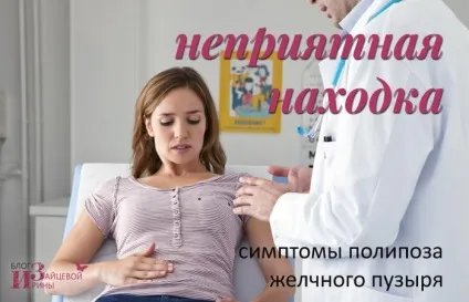 Поліпоз жовчного міхура (поліпоз жовчного міхура. Симптоми. Причини. Лікування) Поліпоз жовчного міхура
