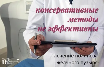 Поліпоз жовчного міхура (поліпоз) Поліпоз жовчного міхура