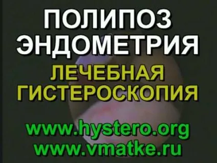 Поліпоз носа що це таке і лікування препаратами тканин пазух (лікування) Поліпоз носа що це таке і лікування препаратами тканин пазух