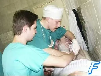 Пізні ускладнення гіпсових пов'язок (невідкладна) Пізні ускладнення гіпсових пов'язок