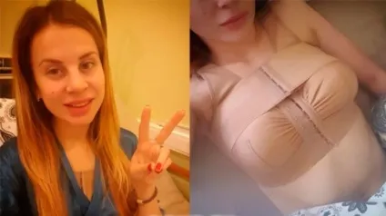 Ольга Жемчугова (ольга вітер) до і після пластики - 300 (вітер) Ольга Жемчугова (ольга вітер) до і після пластики - 300