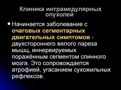 Пухлини спинного мозку симптоми, класифікація, лікування, діагностика раку (пухлини спинного мозку класифікація) Пухлини спинного мозку симптоми, класифікація, лікування, діагностика раку
