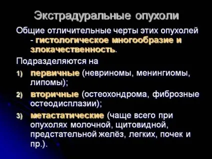 Пухлини спинного мозку симптоми, класифікація, лікування, діагностика раку (пухлина спинного мозку) Пухлини спинного мозку симптоми, класифікація, лікування, діагностика раку