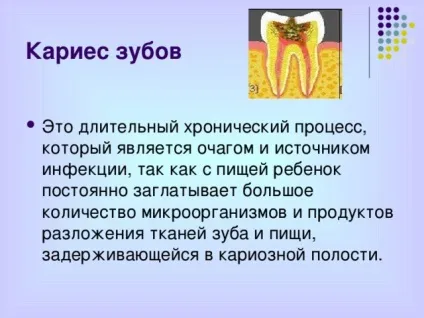 Презентація - профілактика захворювань зубів - біологія, презентації (профілактика) Презентація - профілактика захворювань зубів - біологія, презентації