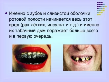 Презентація - профілактика захворювань зубів - біологія, презентації (зубів) Презентація - профілактика захворювань зубів - біологія, презентації