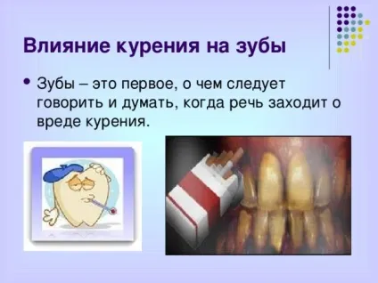 Презентація - профілактика захворювань зубів - біологія, презентації (захворювань) Презентація - профілактика захворювань зубів - біологія, презентації