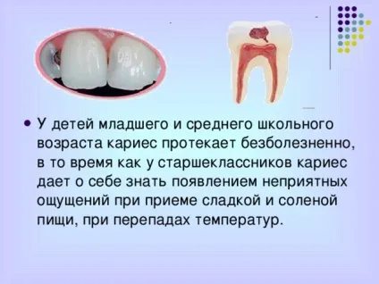 Презентація - профілактика захворювань зубів - біологія, презентації (зубів) Презентація - профілактика захворювань зубів - біологія, презентації