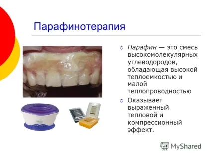 Презентація на тему фізіотерапевтичне лікування захворювань пародонту лекція для студентів 4 курсу (лікування) Презентація на тему фізіотерапевтичне лікування захворювань пародонту лекція для студентів 4 курсу