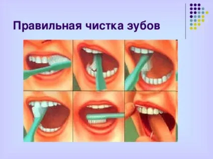 Презентація - профілактика захворювань зубів - біологія, презентації (профілактика) Презентація - профілактика захворювань зубів - біологія, презентації